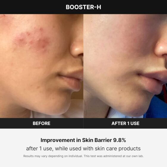 medicube Booster H - Korean Skincare Tool - Image 2