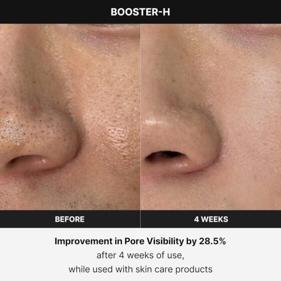 medicube Booster H - Korean Skincare Tool - Image 3