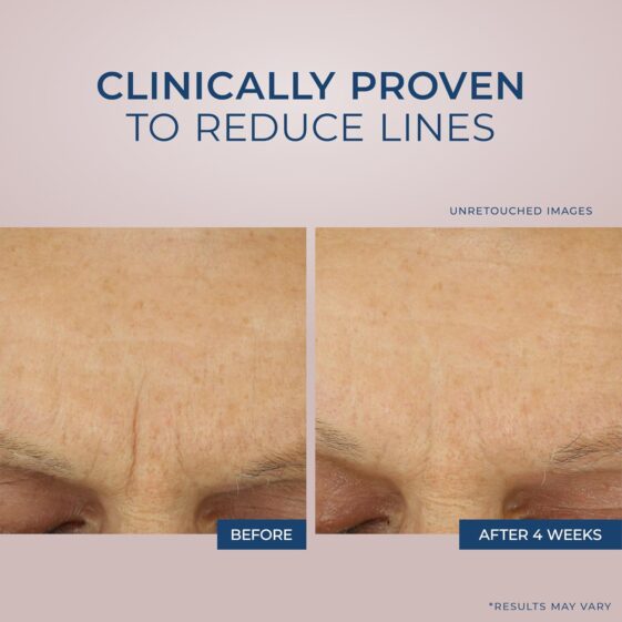 RoC Retinol Correxion - Image 6