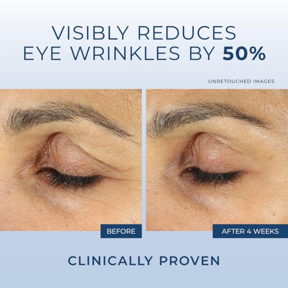 RoC Retinol Correxion Under Eye Cream - Image 3