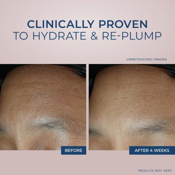 RoC Retinol Correxion - Image 5